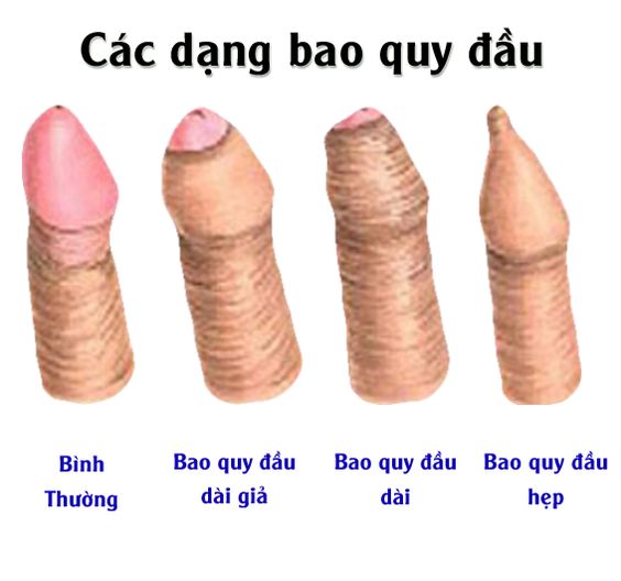 bi-bao-quy-dau-dai-co-sao-khong