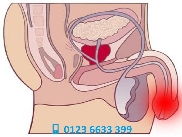 bao quy đầu đỏ và ngứa