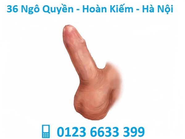 bao quy đầu không tự lột được có làm sao không