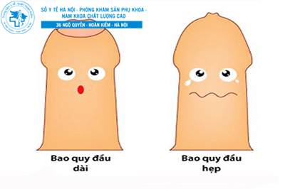 bao quy đầu dài và hẹp